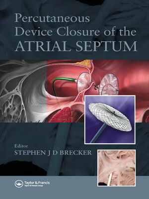 cover image of Percutaneous Device Closure of the Atrial Septum